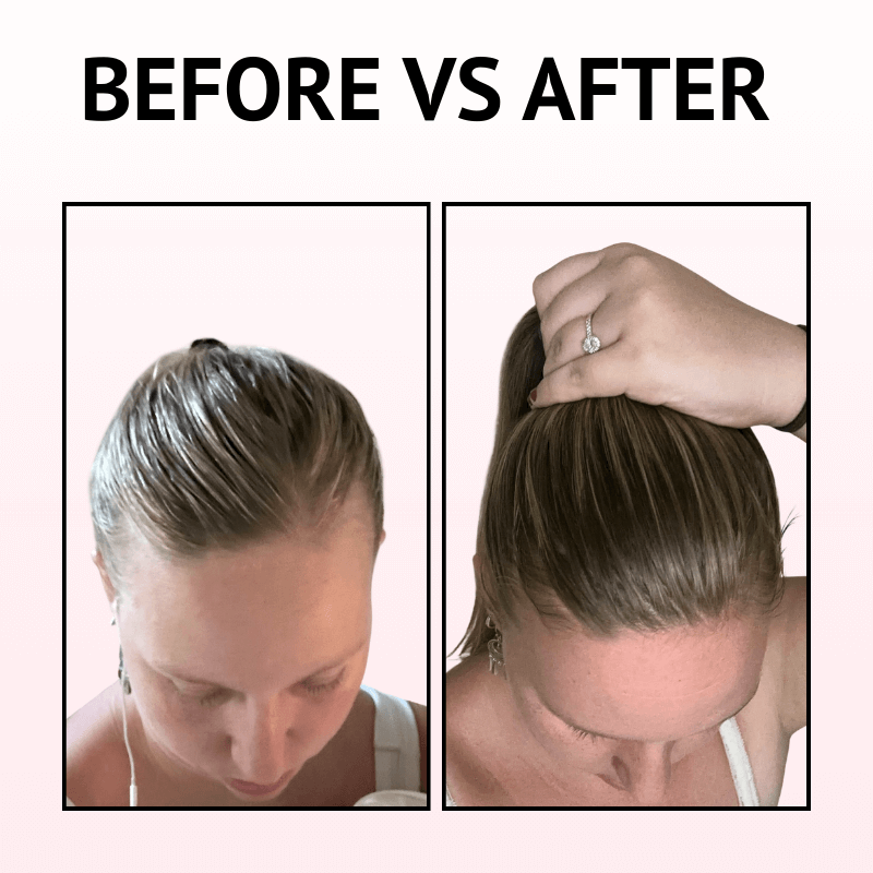 TRESSIQUE™ Premium Light Therapy Brush