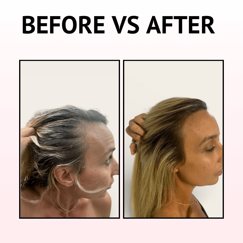 TRESSIQUE™ Premium Light Therapy Brush